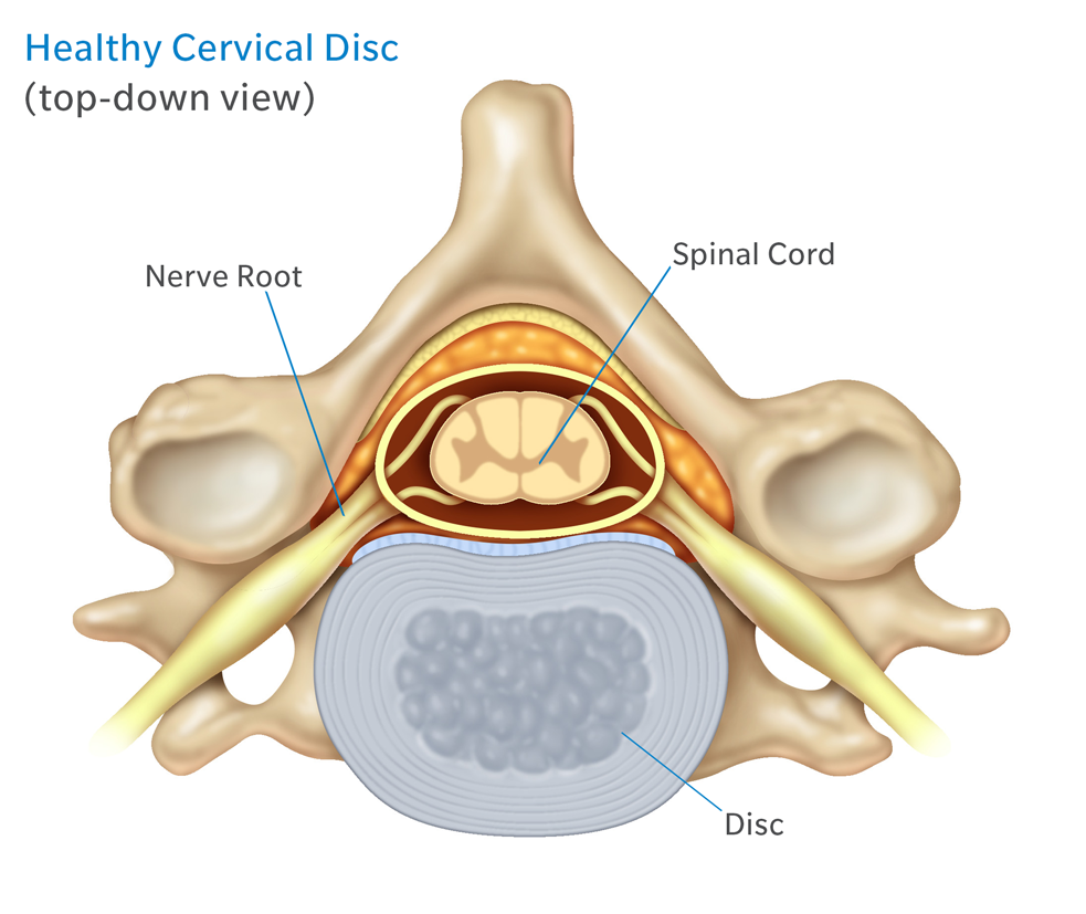 spinal disc